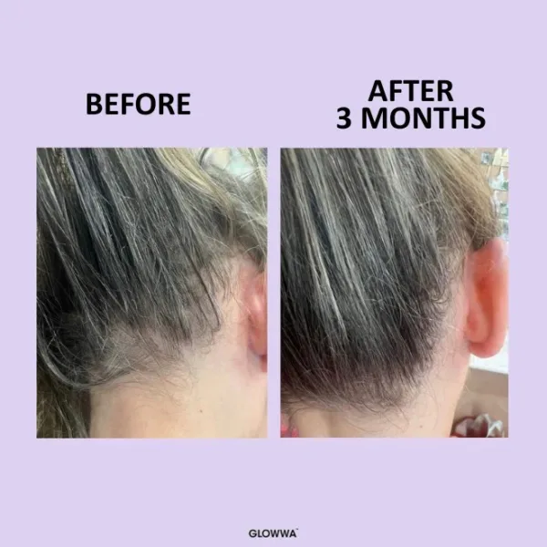 GLOWWA Hair Food™ Menopause Hair Vitamins - Image 4
