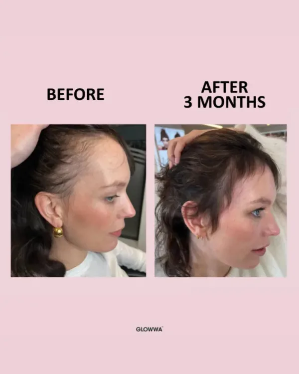 GLOWWA Hair Food™ Hair Vitamins Trio - 3 Month Supply - Image 4