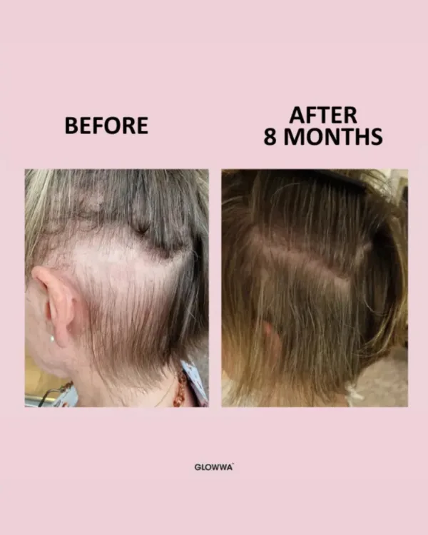 GLOWWA Hair Food™ Hair Vitamins Trio - 3 Month Supply - Image 5